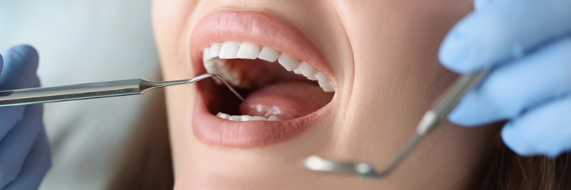 AdobeStock_460293017_Mundhygiene.jpeg